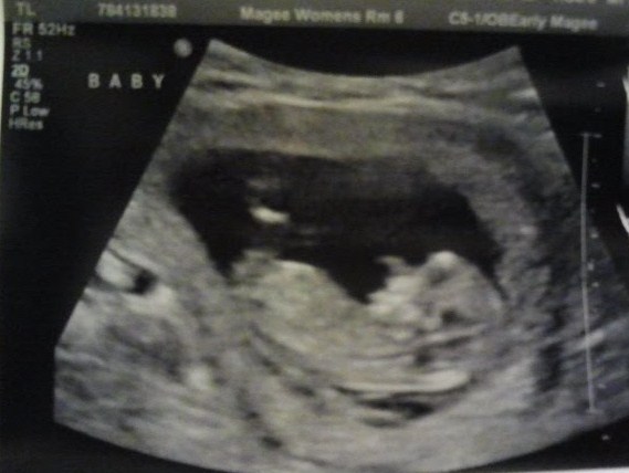 Name:  baby2.jpg
Views: 2782
Size:  50.1 KB