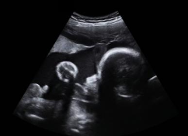 Name:  32weekultrasound.jpg
Views: 169
Size:  8.5 KB