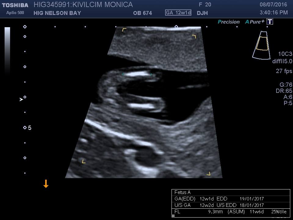 Name:  Lower Limbs 12wks.jpg
Views: 606
Size:  51.1 KB