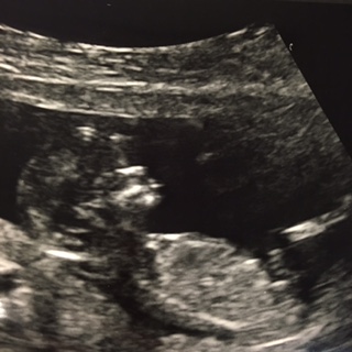 Name:  Baby Coutu 1.jpg
Views: 121
Size:  39.9 KB