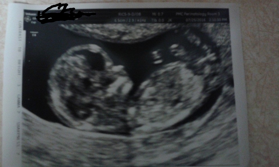 Name:  Baby!.jpg
Views: 134
Size:  118.9 KB