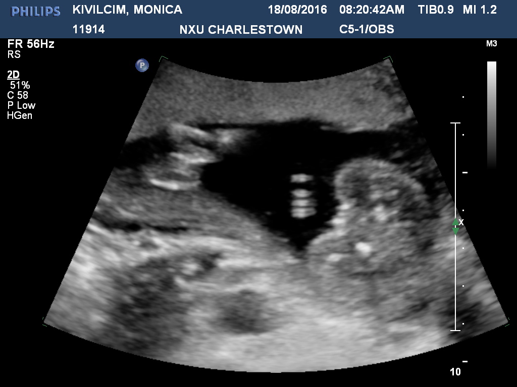 Name:  POTTY SHOT 18 WEEKS.jpg
Views: 487
Size:  152.0 KB