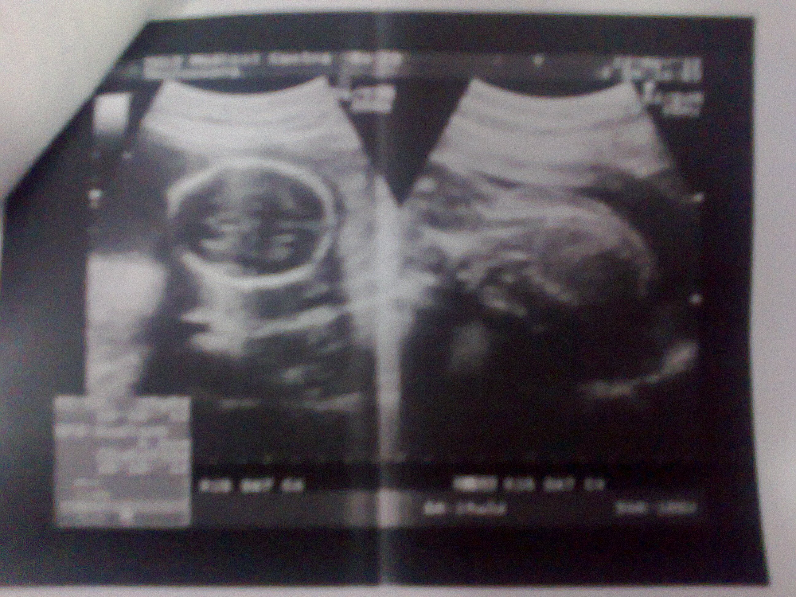 Name:  Photo1241.jpg
Views: 142
Size:  1.24 MB