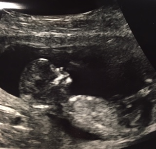 Name:  Baby Coutu 2.jpg
Views: 824
Size:  38.4 KB