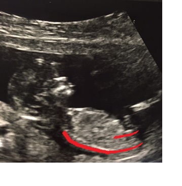Name:  Baby Coutu 8.jpg
Views: 405
Size:  35.3 KB