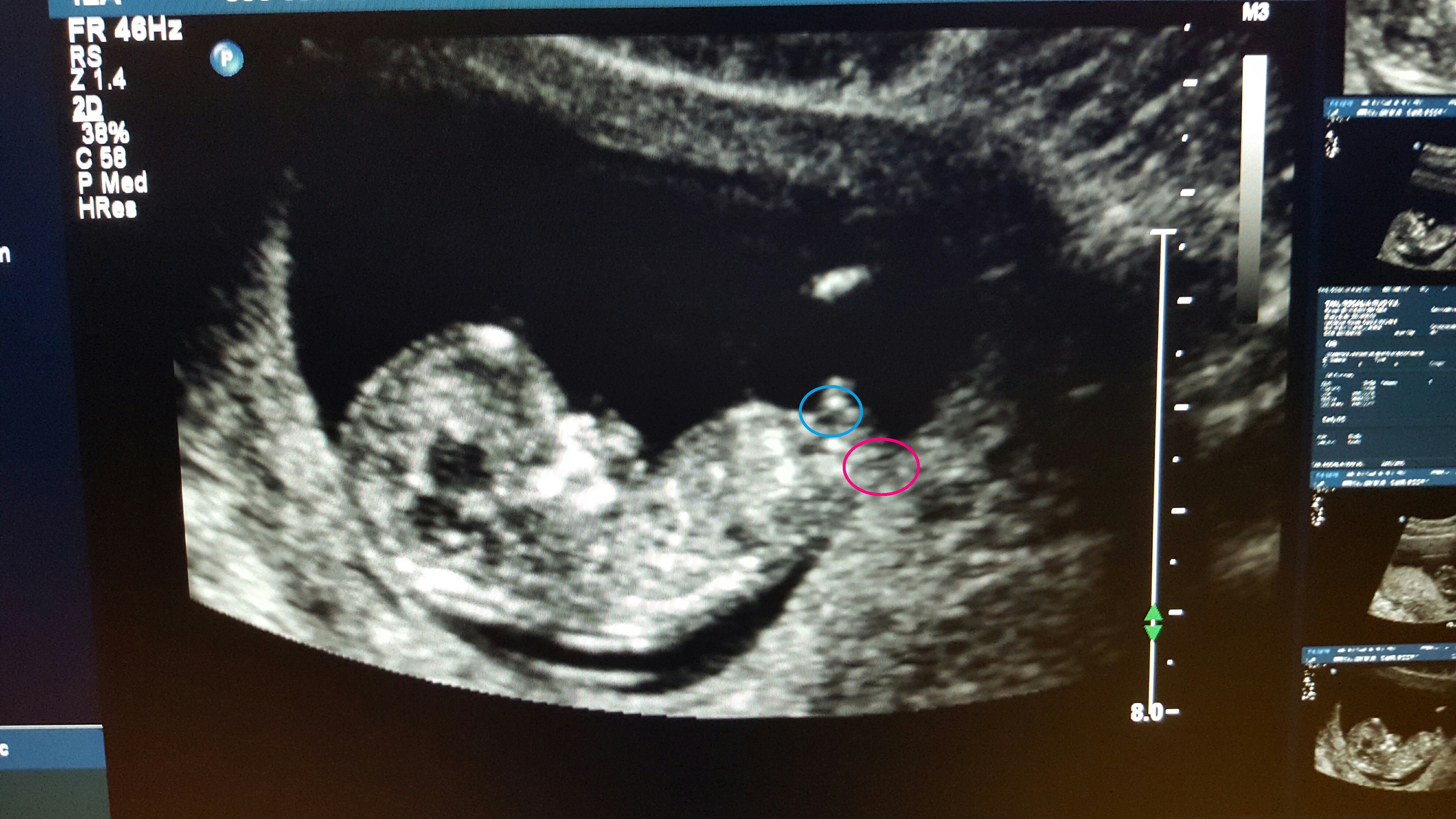 Name:  peanut boy or girl.jpg
Views: 271
Size:  2.34 MB