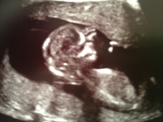 Name:  12wk skull.JPG
Views: 278
Size:  87.2 KB