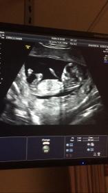 Name:  IMG_2010.jpg
Views: 243
Size:  7.6 KB