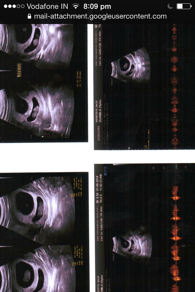 Name:  image.jpeg
Views: 478
Size:  194.7 KB