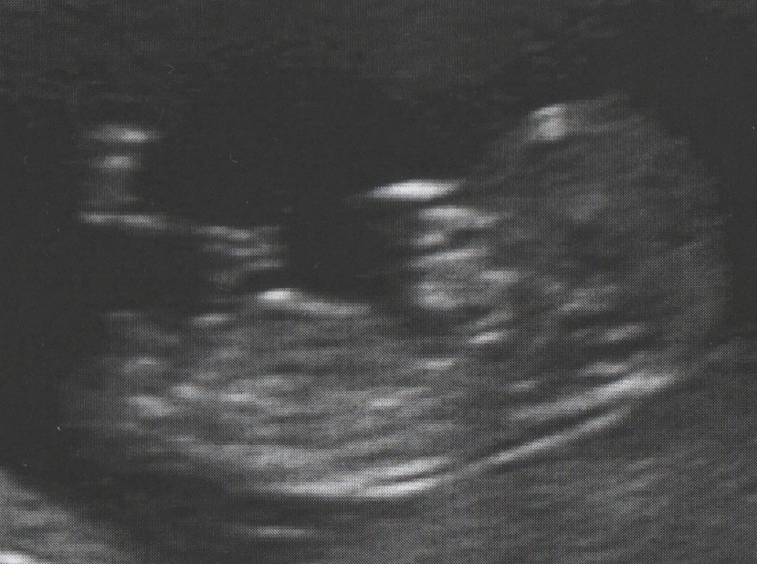 Name:  baby1.jpg
Views: 2440
Size:  246.8 KB