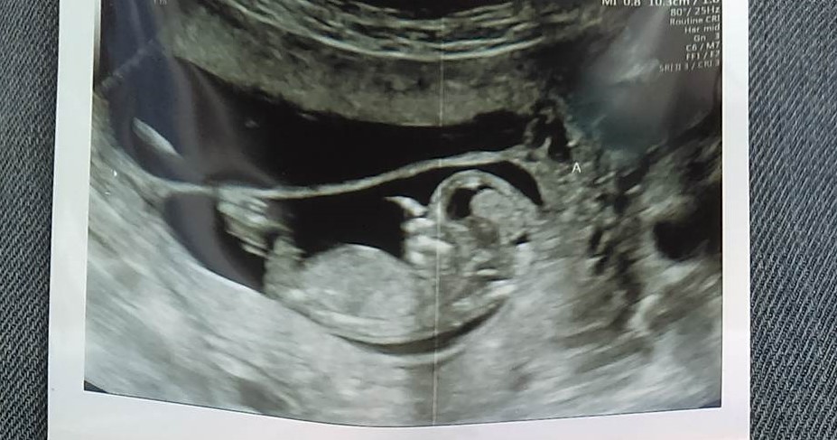 Name:  baby a.jpg
Views: 397
Size:  131.9 KB