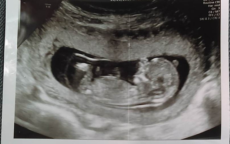 Name:  baby b.jpg
Views: 891
Size:  100.4 KB