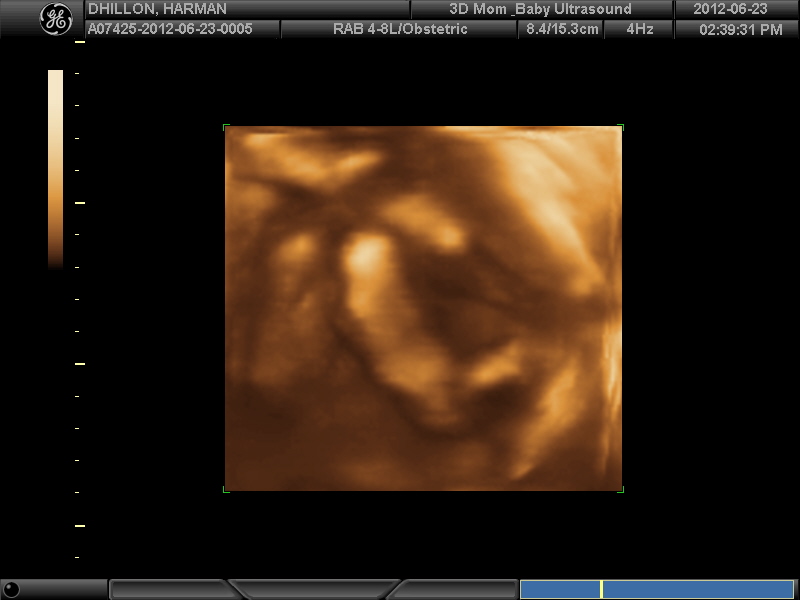 Name:  3D BABY_16.JPG
Views: 193
Size:  72.2 KB
