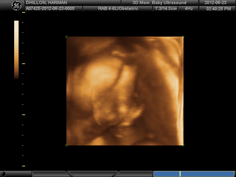 Name:  3D BABY_17.JPG
Views: 190
Size:  73.0 KB