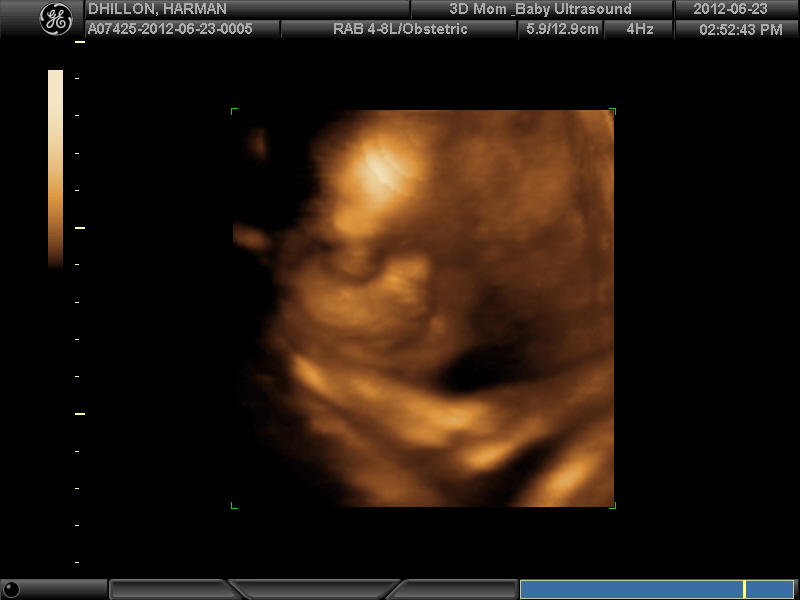 Name:  3D BABY_30.JPG
Views: 186
Size:  69.8 KB