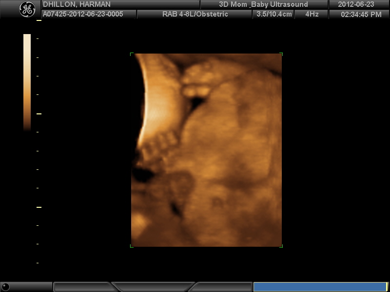 Name:  3D BABY_13.JPG
Views: 168
Size:  69.9 KB