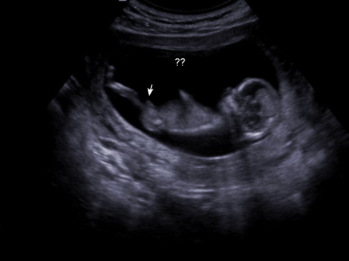 Name:  12 WEEKS_0020 (2).JPG
Views: 290
Size:  63.8 KB
