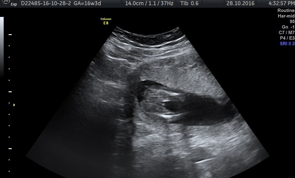 Name:  bby1.jpeg
Views: 232
Size:  103.6 KB