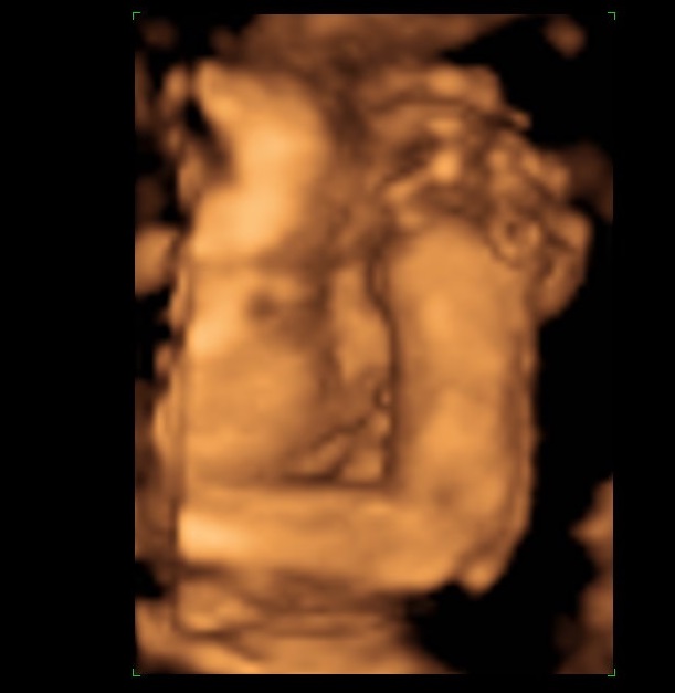 Name:  face1.jpg
Views: 201
Size:  44.6 KB