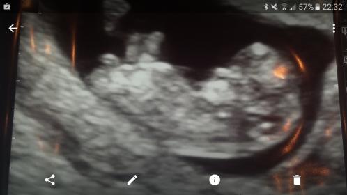 Name:  Screenshot_20161113-223229.jpg
Views: 233
Size:  15.5 KB