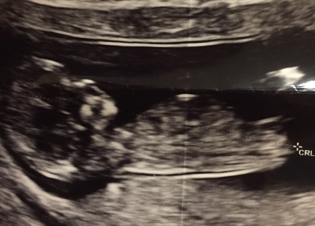 Name:  babypic2.jpg
Views: 258
Size:  234.8 KB