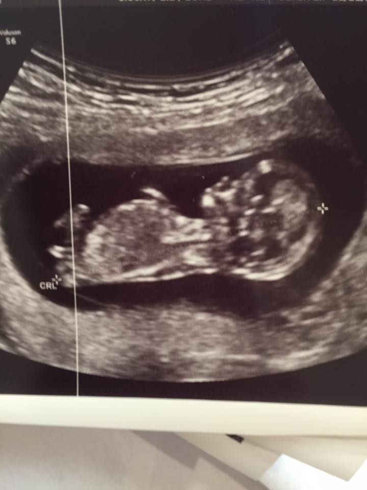 Name:  baby2017.jpg
Views: 848
Size:  46.7 KB
