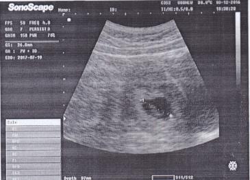 Name:  Scan1.jpg
Views: 1764
Size:  19.4 KB