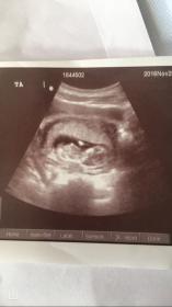 Name:  IMG_1742.jpg
Views: 262
Size:  5.9 KB