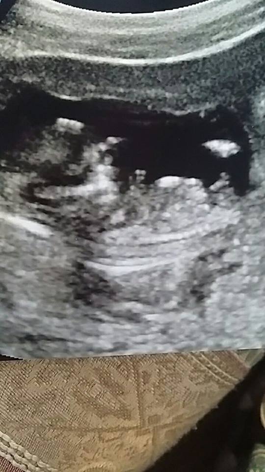 Name:  baby57.jpg
Views: 232
Size:  64.2 KB