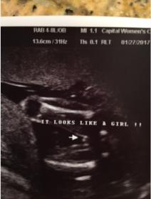 Name:  baby girl.jpg
Views: 735
Size:  9.0 KB