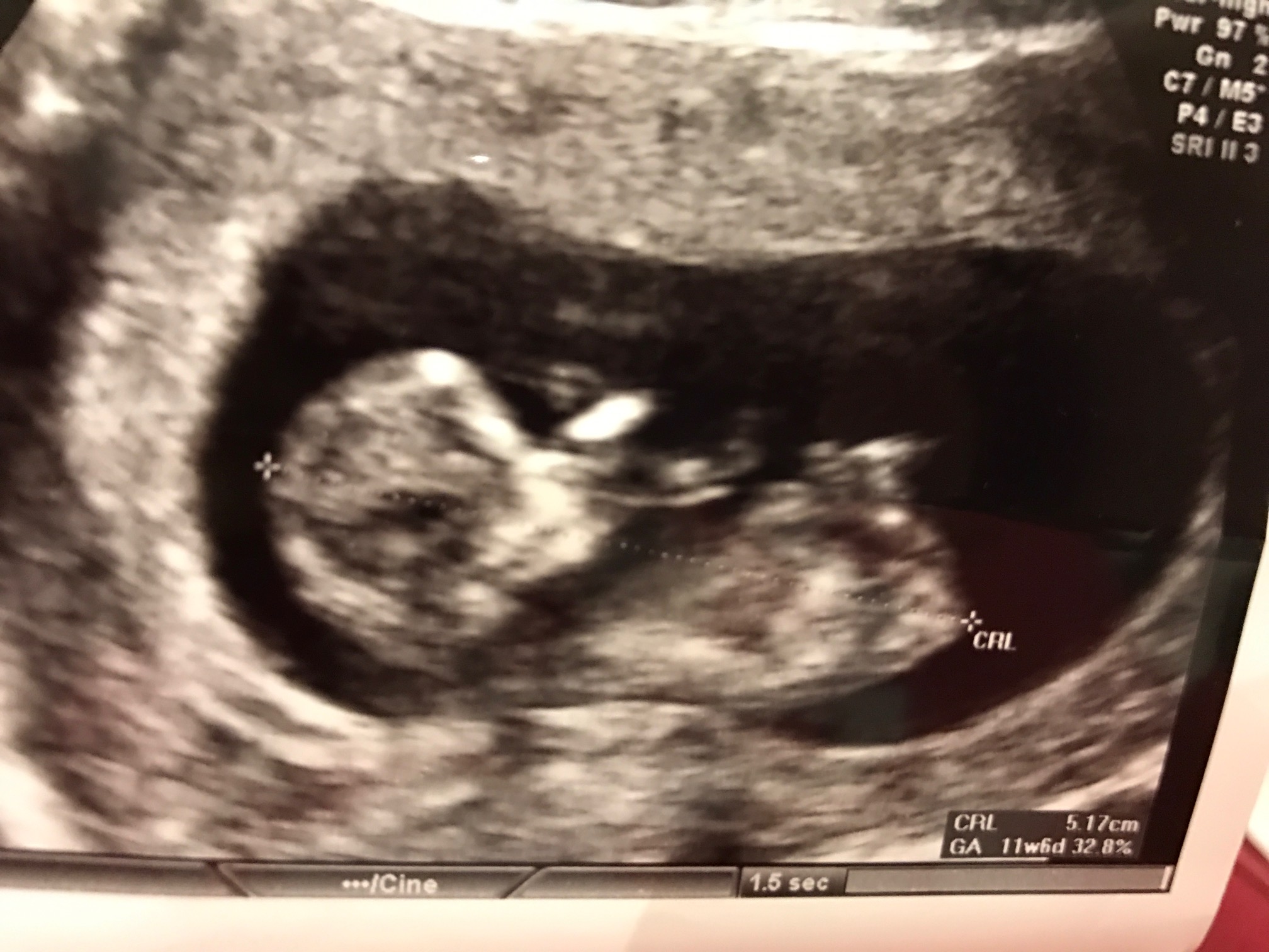 Name:  my baby.jpg
Views: 1019
Size:  470.7 KB