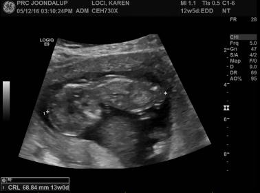 Name:  BABY #3.jpg
Views: 214
Size:  14.2 KB