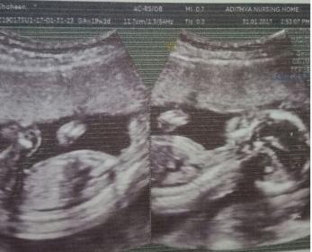 Name:  skull of my baby.jpg
Views: 146
Size:  17.6 KB