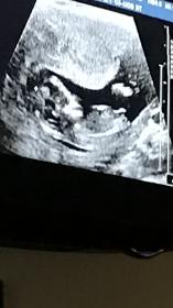 Name:  ultrasound.jpg
Views: 133
Size:  8.7 KB