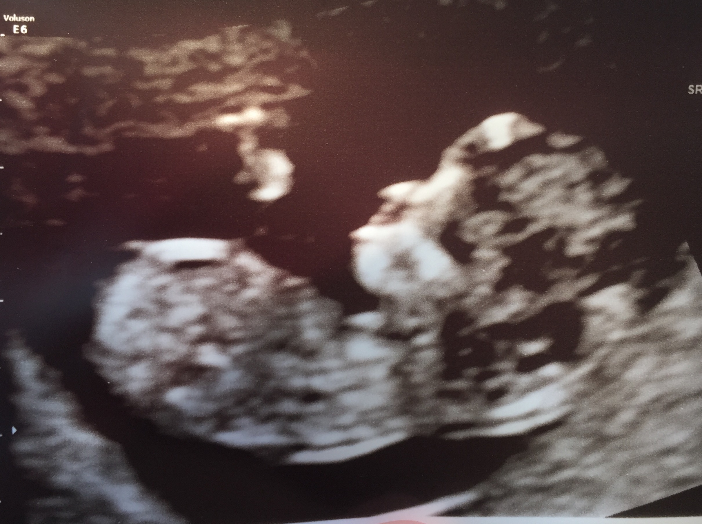 Name:  baby.jpg
Views: 573
Size:  815.3 KB