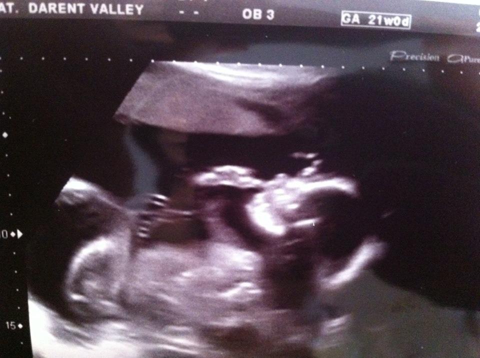 Name:  sadie scan.jpg
Views: 149
Size:  75.1 KB