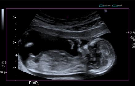 Name:  Screen Shot 2017-02-21 at 4.12.04 pm.jpg
Views: 3241
Size:  15.6 KB