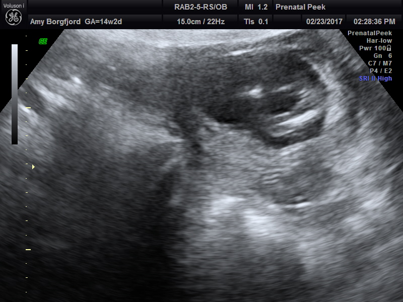 Name:  ULTRASOUND_34.JPG
Views: 343
Size:  173.4 KB