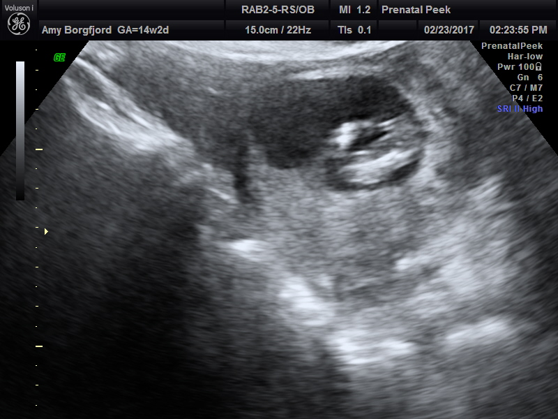 Name:  ULTRASOUND_27.JPG
Views: 342
Size:  167.2 KB