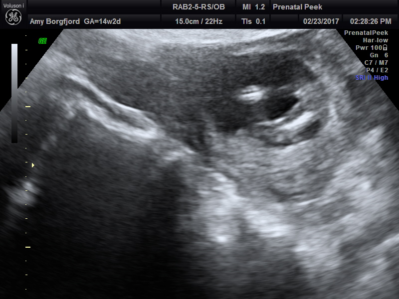 Name:  ULTRASOUND_32.JPG
Views: 337
Size:  162.5 KB