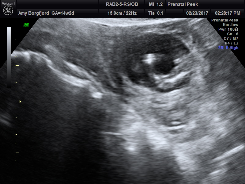 Name:  ULTRASOUND_30.JPG
Views: 352
Size:  165.0 KB