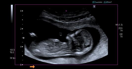 Name:  Screen Shot 2017-03-03 at 4.23.29 pm.jpg
Views: 354
Size:  16.6 KB