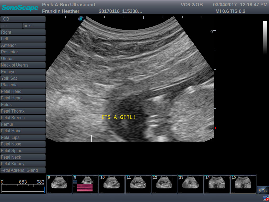 Name:  81478793f94e6b270f6dd89198aea91c.jpg
Views: 321
Size:  153.7 KB