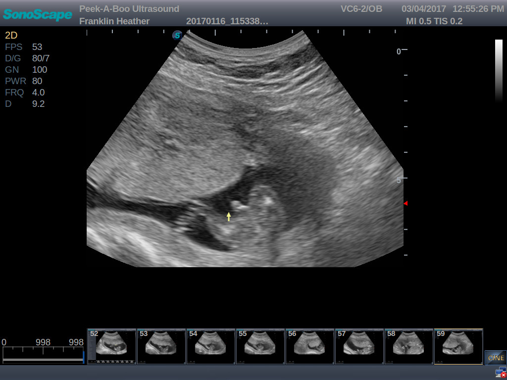 Name:  fe6fb6d8023b88feeab89f3b55d84a74.jpg
Views: 285
Size:  125.4 KB