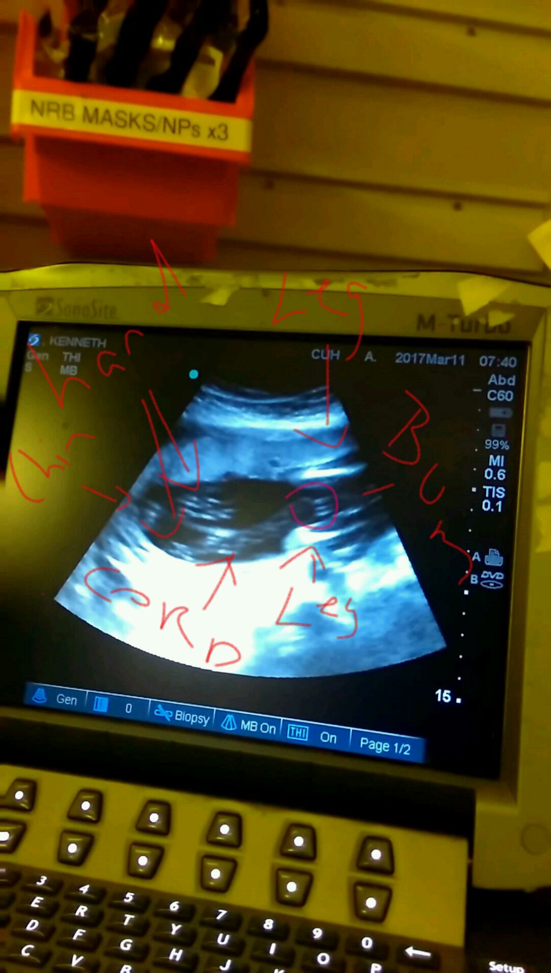 Name:  VIDEO0115_0000146189_1.jpg
Views: 335
Size:  197.8 KB
