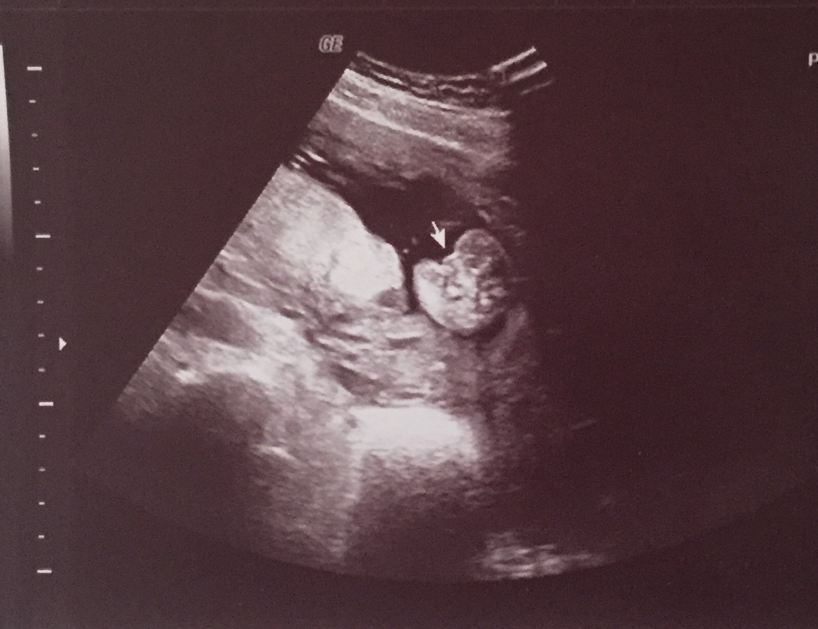 Name:  ultrasound.jpg
Views: 1755
Size:  329.5 KB