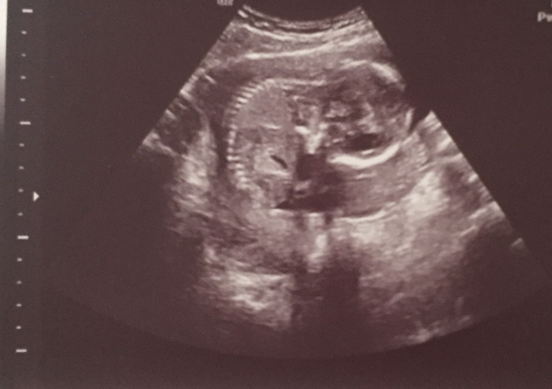 Name:  ultrasound4.jpg
Views: 208
Size:  379.9 KB