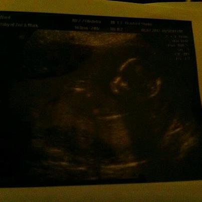 Name:  little man.jpg
Views: 56
Size:  12.9 KB