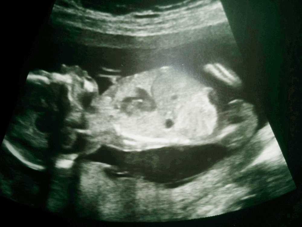 Name:  15+3_bis.gif
Views: 190
Size:  286.9 KB