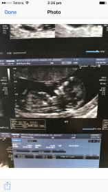Name:  IMG_1136.jpg
Views: 139
Size:  9.7 KB